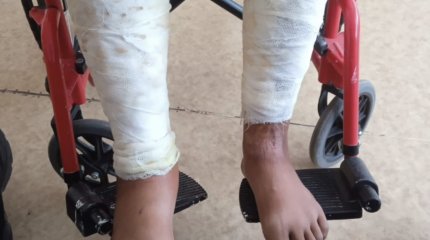 Подросток поджег приятеля в Карагандинской области