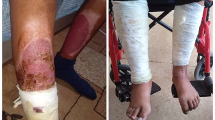 Қарағандыда жасөспірім қатарласына сіріңке лақтырып, өртеп жібермек болған