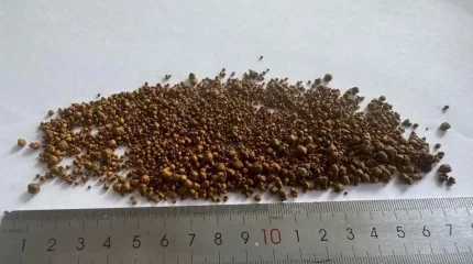 Алматы дәрігерлері қырық жастағы ер адамның өтінен 5499 тас алып шыққан