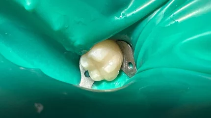 Адам тісі алғаш рет зертханада өсірілді: стоматологияда төңкеріс болуы мүмкін