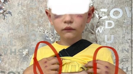 8-летнего ребёнка избили в Лисаковске