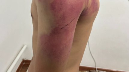 Атырауда сегізінші сыныптың екі баласын жоғары сынып оқушылары аяусыз соққыға жыққан