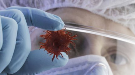 Әлемде жылына 20 млн адам қатерлі ісікке шалдығады