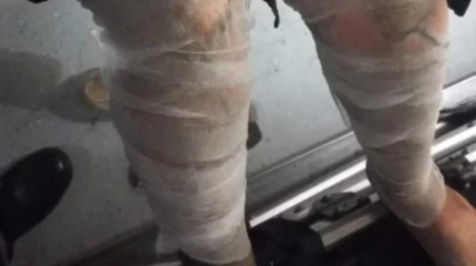 Павлодарда көлік өртеніп, бес адам зардап шекті