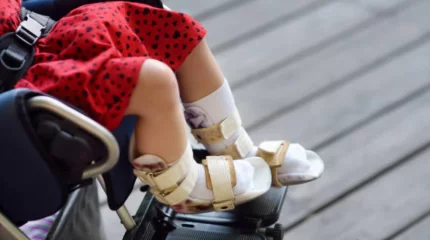 Абай облысында мүгедек балаларға тиесілі төлемдер берілмей келген