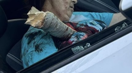 Женщину проткнуло упавшее дерево в Аксу