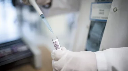 Ганада маймыл шешегінен 1 адам қайтыс болды