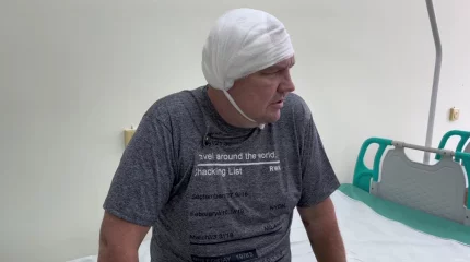 Гигантскую опухоль головного мозга удалили пациенту врачи в СКО