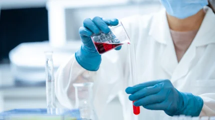 Батыс Қазақстан облысында шошқа тұмауы да тіркелді