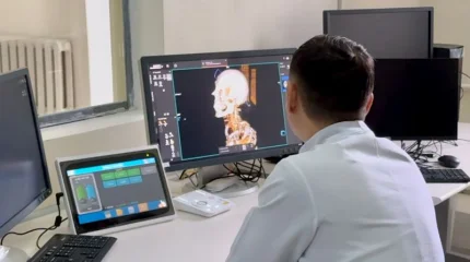 Ұлттық шұғыл медицинаны үйлестіру орталығының инсульт бөлімшесінде былтыр 53 мың науқас емделген