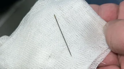 8 айлық сәбидің ішінен ине шықты