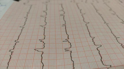 4500 казахстанцев нуждаются в пересадке органов