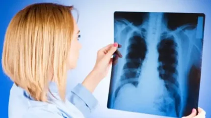 Туберкулезге шалдыққандар азайды