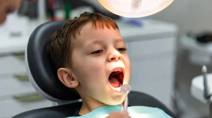 Кариес как тревожный сигнал: ученые связали проблемы с зубами в детстве с риском инсульта