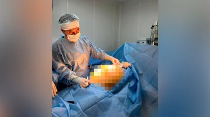 Алматыдағы дәрігерлер науқастан 25 келілік ісікті алып тастады