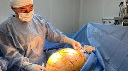 Алматыда дәрігерлер 25 келілік ісікті алып тастады