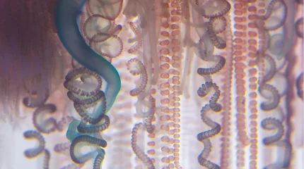 Критические для жизни ожоги научились лечить с помощью морских червей