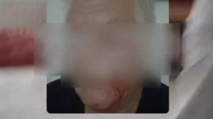 Түркістан облысында әйел күйеуін оқтаумен ұрып, ер адам көзінен айырыла жаздады