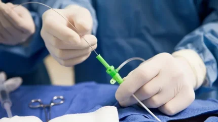 Қызылорда облысында отадан кейін науқастың денесінде дәке қалып кеткен: сот медициналық мекемені кінәлі деп таныды