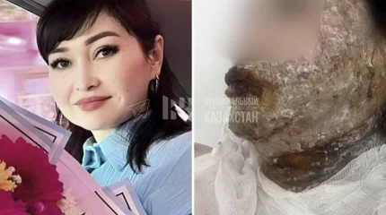 В Шымкенте мужчина облил бывшую жену горючей жидкостью и сбежал в Алматы