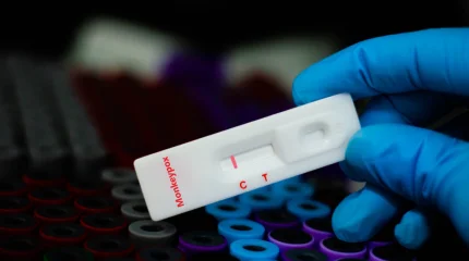 Оңтүстік Африкада маймыл шешегі таралып жатыр